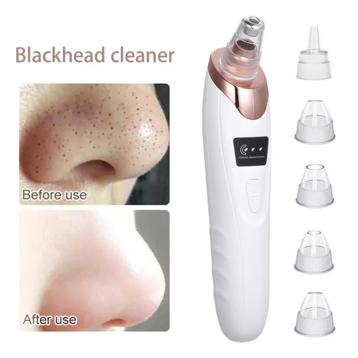 Electric Blackhead Remover Vacuum – Deep Pore Cleaner Machine