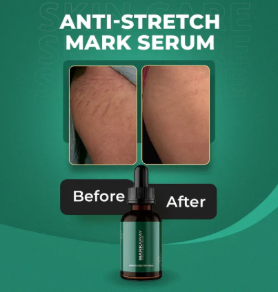 Markaway Stretch Mark Serum – Fast Skin Repair & Smooth Skin ✨